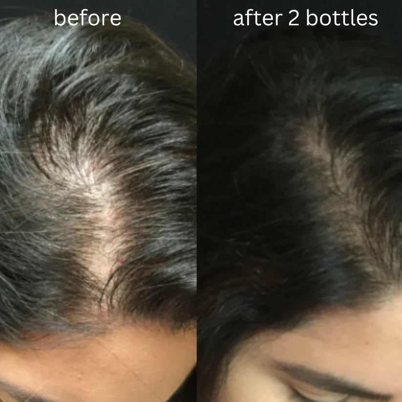 Parsa Organics Hair Oil + Shampoo Combo Deal